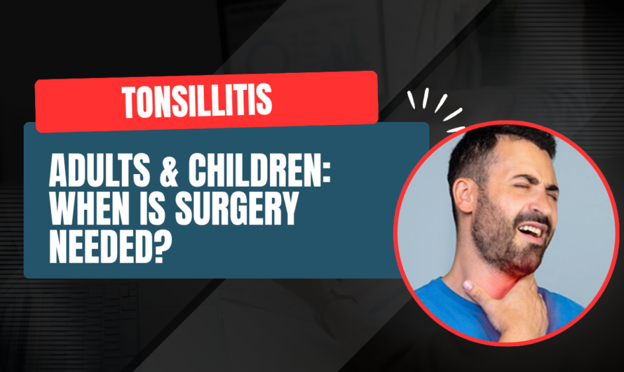 Tonsillitis in Adults & Children: When Is Tonsil Surgery Needed?