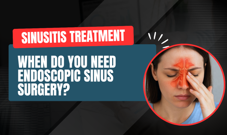 Sinusitis Treatment: When Do You Need Endoscopic Sinus Surgery?