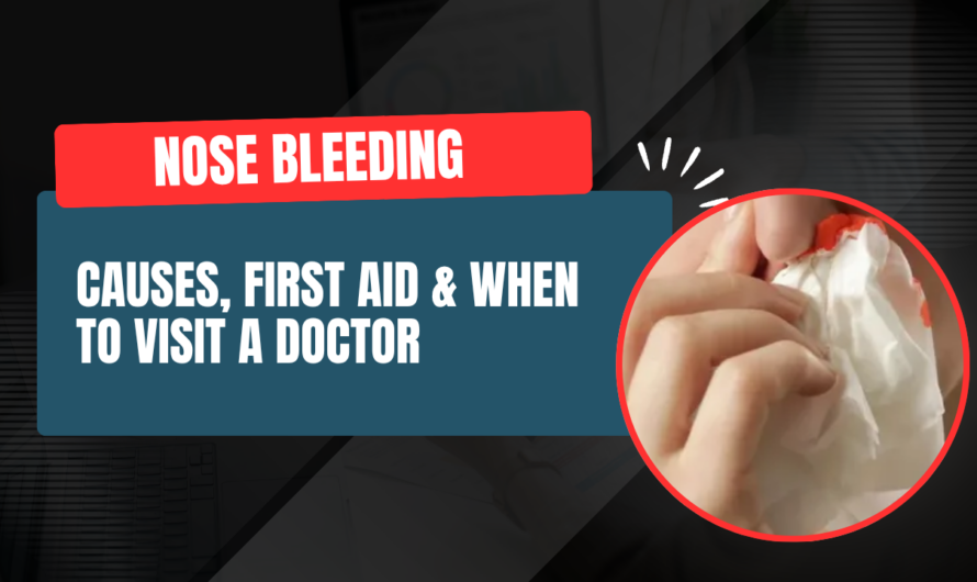 Nose Bleeding (Epistaxis): Causes, First Aid & When to Visit a Doctor