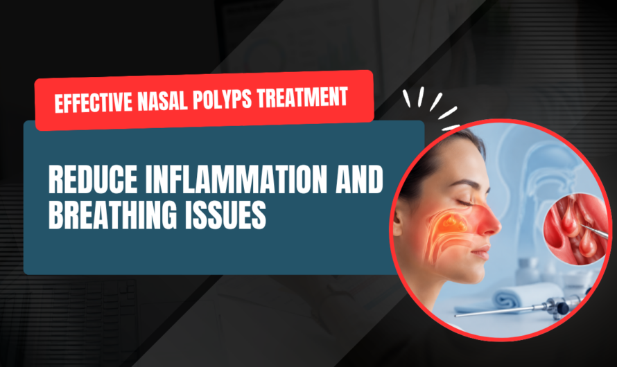 What Are Nasal Polyps: Symptoms, Recurrence & Treatment